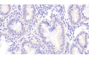 Detection of TECK in Human Small intestine Tissue using Polyclonal Antibody to Thymus Expressed Chemokine (TECK) (CCL25 antibody  (AA 24-150))