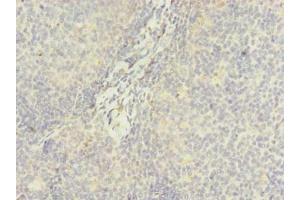 Immunohistochemistry of paraffin-embedded human tonsil tissue using ABIN7144990 at dilution of 1:100 (DDX42 antibody  (AA 519-819))