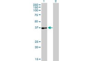 Western Blot analysis of PHYH expression in transfected 293T cell line by PHYH monoclonal antibody (M01), clone 1F2-5B9.
