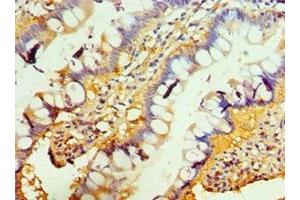 Immunohistochemistry of paraffin-embedded human small intestine tissue using ABIN7173851 at dilution of 1:100 (TACI antibody  (AA 184-293))