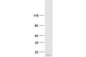 Validation with Western Blot (TSPO Protein (Transcript Variant PBR) (Myc-DYKDDDDK Tag))