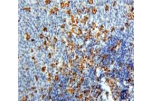 #VALUE! (PF4 antibody  (AA 30-105))
