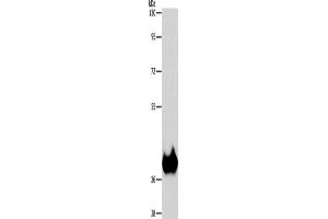 Western Blotting (WB) image for anti-Aspartoacylase (ASPA) antibody (ABIN2429545) (ASPA antibody)