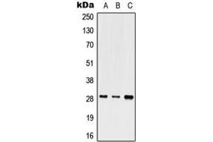 Western blot analysis of SHOX expression in HEK293T (A), Raw264. (SHOX antibody  (Center))