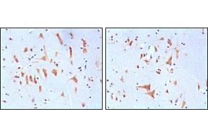 Immunohistochemical analysis of paraffin-embedded human brain tissues, showing cytoplasmic localization with DAB staining using FMR1 mouse mAb.