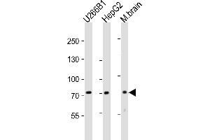 Western blot analysis of lysates from U266B1,HepG2 cell line,mouse brain tissue lysate(from left to right), using NT5E-M535 Antibody at 1:2000 at each lane. (CD73 antibody  (C-Term))