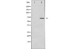 Western blot analysis of PKCB expression in HeLa whole cell lysates,The lane on the left is treated with the antigen-specific peptide. (PKC beta antibody  (C-Term))