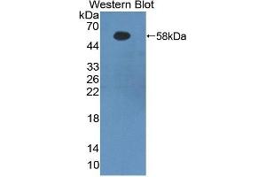 Western Blotting (WB) image for anti-Fibrinogen beta Chain (FGB) (AA 29-491) antibody (ABIN1858852)