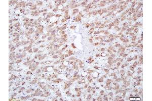 Immunohistochemistry (Paraffin-embedded Sections) (IHC (p)) image for anti-Major Facilitator Superfamily Domain Containing 2A (MFSD2A) (AA 331-430) antibody (ABIN762026)