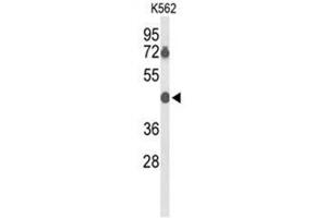 Western blot analysis of BTBD10 Antibody (Center) in K562 cell line lysates (35µg/lane).