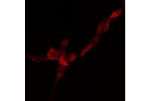 ABIN6274757 staining HuvEc cells by IF/ICC. (RPS4Y1 antibody)