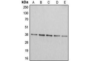 Western blot analysis of Arginase 2 expression in Jurkat (A), HepG2 (B), HEK293T (C), A549 (D), PC12 (E) whole cell lysates.