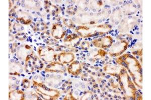 IHC testing of FFPE mouse kidney with SLC22A2 antibody. (WNT7A antibody)