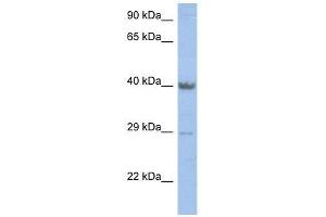 ZNF474 antibody used at 2. (ZNF474 antibody  (Middle Region))