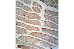 Immunohistochemistry (Paraffin-embedded Sections) (IHC (p)) image for anti-Pyruvate Dehydrogenase Kinase, Isozyme 4 (PDK4) (AA 382-410), (C-Term) antibody (ABIN391039)