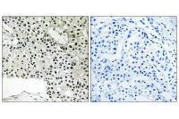 TCEAL4 antibody