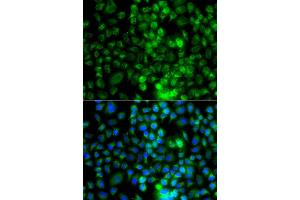 Immunofluorescence analysis of A549 cell using EPHA1 antibody.