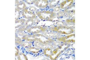 Immunohistochemistry of paraffin-embedded mouse kidney using CRY1 antibody at dilution of 1:200 (40x lens). (CRY1 antibody)