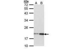 Image no. 1 for anti-Non-Metastatic Cells 1, Protein (NM23A) Expressed in (NME1) (AA 1-120) antibody (ABIN467572) (NME1 antibody  (AA 1-120))