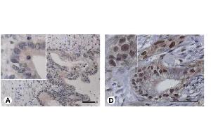 Image no. 1 for anti-Integrin-Binding Sialoprotein (IBSP) antibody (ABIN191813) (IBSP antibody)