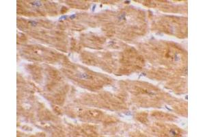 Immunohistochemistry (Paraffin-embedded Sections) (IHC (p)) image for anti-Caspase 1 (CASP1) (C-Term) antibody (ABIN499541)