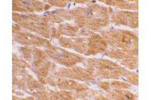 Immunohistochemical staining of human heart tissue using AP30187PU-N Caspase-1 antibody at 2 μg/ml.