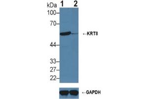 Rabbit Detection antibody from the kit in WB with Positive Control:  Sample Knockout Varification: Lane 1: Wild-type Hela cell lysate; Lane 2: KRT8 knockout Hela cell lysate;. (KRT8 ELISA Kit)