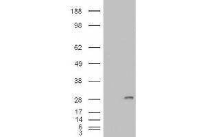 Image no. 2 for anti-Insulin-Like Growth Factor Binding Protein 6 (IGFBP6) (Internal Region) antibody (ABIN374965)
