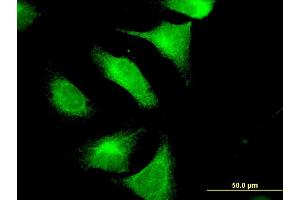 Immunofluorescence of monoclonal antibody to CNTN4 on HeLa cell. (Contactin 4 antibody  (AA 800-898))