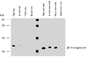 Western blotting analysis of human β2-microglobulin using mouse monoclonal antibody B2M-02 on lysates of various cell lines under reducing and non-reducing conditions. (beta-2 Microglobulin antibody)