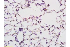 Formalin-fixed and paraffin embedded rat lung labeled with Anti PABP Polyclonal Antibody, Unconjugated (ABIN704786) at 1:200 followed by conjugation to the secondary antibody and DAB staining