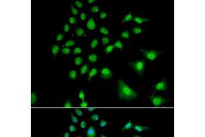 Immunofluorescence analysis of U2OS cells using UBE3C Polyclonal Antibody (UBE3C antibody)