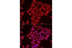 Immunofluorescence analysis of HeLa cells using ST3GAL3 antibody. (ST3GAL3 antibody  (AA 30-375))