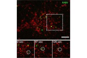 Co-localization of RABV with p75NTR in DRG neuron tips.