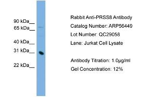 WB Suggested Anti-PRSS8  Antibody Titration: 0.