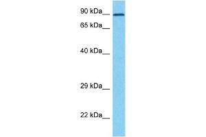 Host:  Rabbit  Target Name:  ZP2  Sample Type:  HT1080 Whole Cell lysates  Antibody Dilution:  1. (ZP2 antibody  (C-Term))