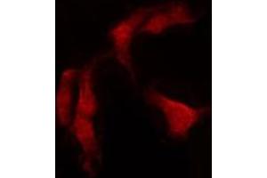 ABIN6274171 staining HepG2 by IF/ICC. (PRKCSH antibody  (Internal Region))