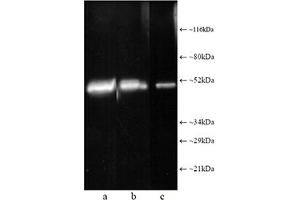 Western blot analysis: Composite luminograph of (a) HeLa S3 cytosolic preparation, (b) purified 26S proteasome, and (c) human placental proteasome fraction after SDS PAGE followed by blotting onto PVDF membrane and probing with antibody . (Proteasome 19S Rpt1/S7 Subunit antibody)