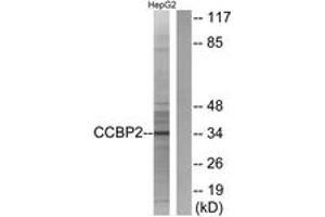 Western blot analysis of extracts from HepG2 cells, using CCBP2 Antibody. (CCBP2 antibody  (AA 335-384))