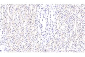 Detection of CCND1 in Rat Kidney Tissue using Polyclonal Antibody to Cyclin D1 (CCND1) (Cyclin D1 antibody  (AA 1-295))