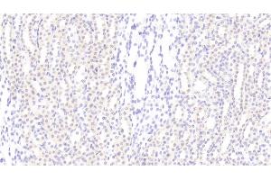 Detection of CCND1 in Rat Kidney Tissue using Polyclonal Antibody to Cyclin D1 (CCND1) (Cyclin D1 antibody  (AA 1-295))