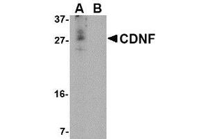 Western blot analysis of CDNF in A-20 cell lysate in (A) the absence and (B) the presence of blocking peptide with AP30222PU-N CDNF antibody at 1 μg/ml.