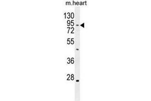 TBC14 Antibody (Center) western blot analysis in mouse heart tissue lysates (35µg/lane). (TBC1D14 antibody  (Middle Region))