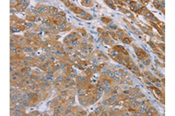 SAMD4A antibody