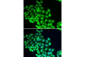 Immunofluorescence analysis of HeLa cells using ERCC2 antibody.