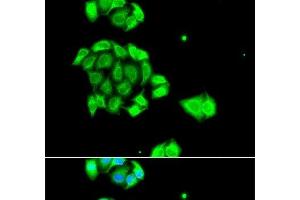 Immunofluorescence analysis of A549 cells using Rad51D Polyclonal Antibody (RAD51D antibody)