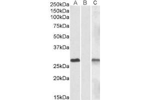 Lane A - ABIN570830 (1µg/ml) staining of HEK293 overexpressing Human DYDC1 lysate (10µg protein in RIPA buffer) Lane B - ABIN570830 (1µg/ml) staining of HEK293 mock-transfected lysate (10µg protein in RIPA buffer). (DYDC1 antibody  (Internal Region))