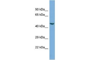 Western Blotting (WB) image for anti-Cyclin-Dependent Kinase 19 (CDK19) (C-Term) antibody (ABIN2786077) (CDK19 antibody  (C-Term))