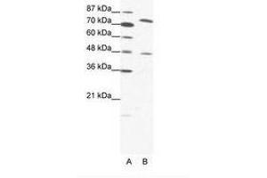 Image no. 1 for anti-Zinc Finger Protein 225 (ZNF225) (AA 127-176) antibody (ABIN202877)