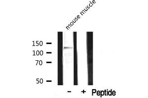 Western blot analysis on mouse muscle lysate using MAST2 Antibody (MAST2 antibody  (Internal Region))